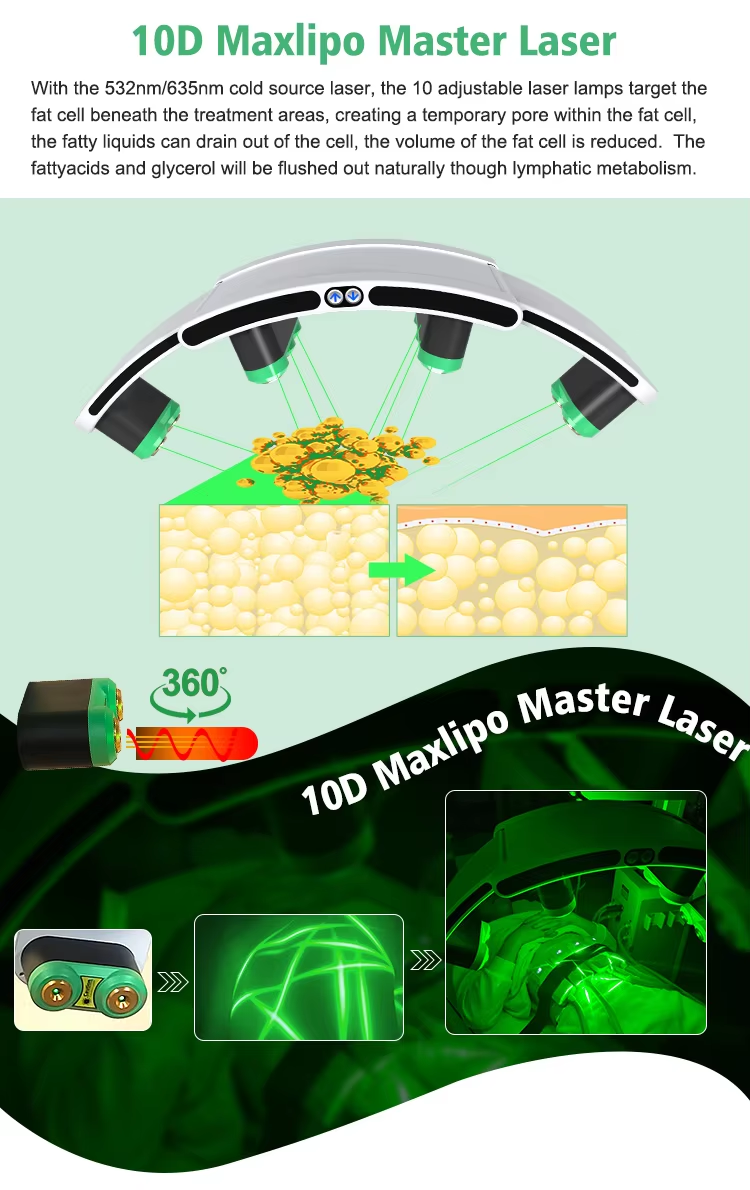10D Maxipo Master Laser Cryo plate 1
