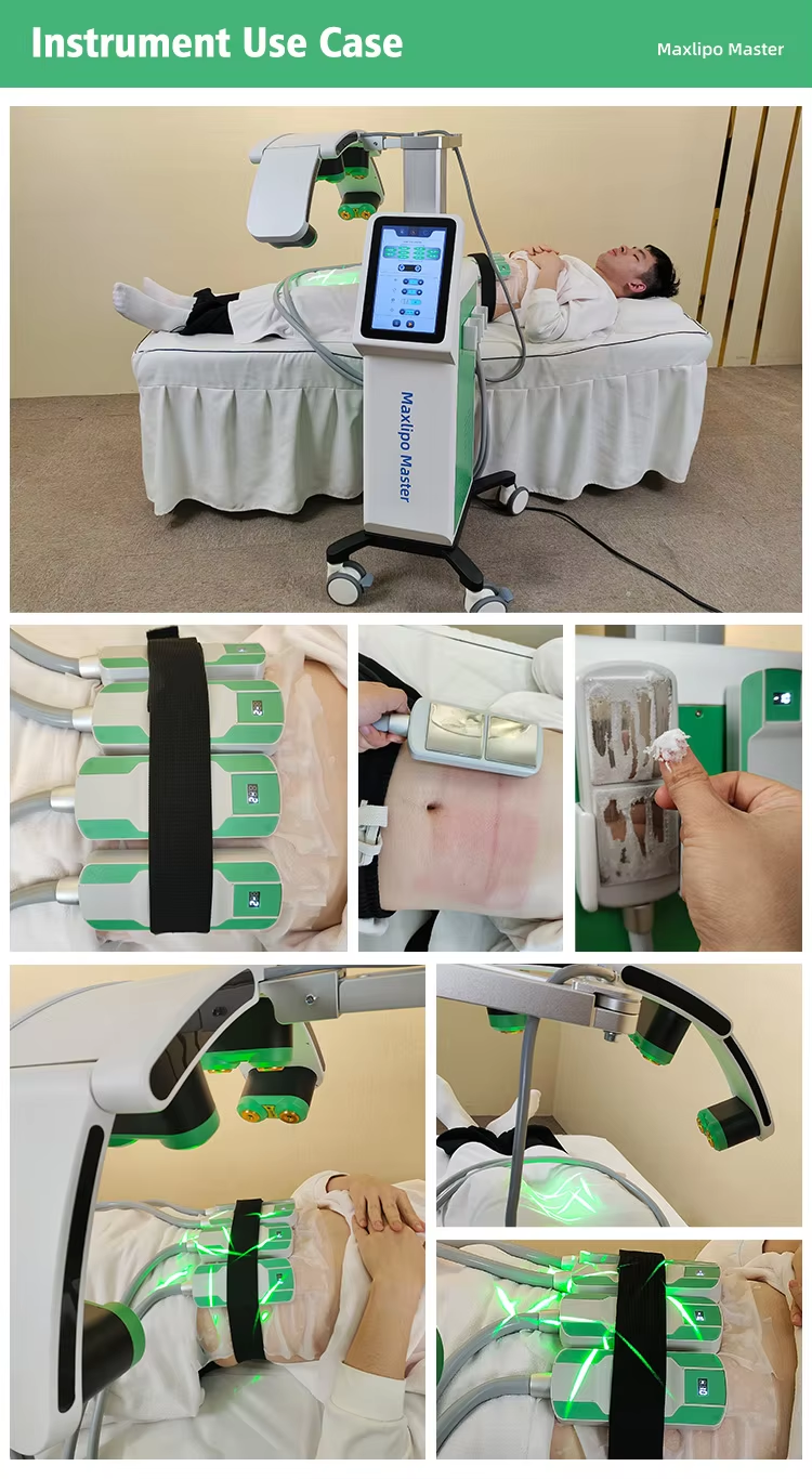 10D Maxipo Master Laser Cryo plate 1