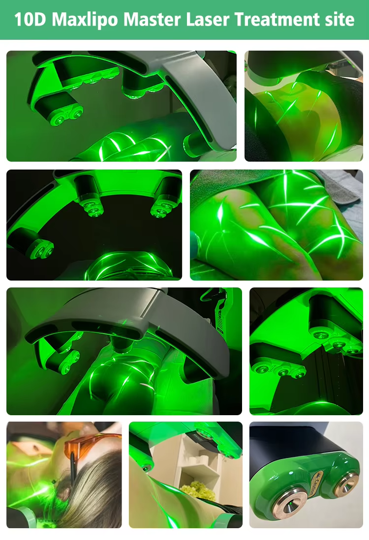 10D Maxipo Master Laser Cryo plate 1