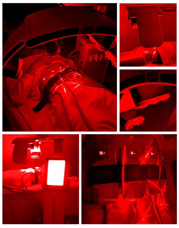 10D Maxipo Master Laser Cryo plate 1