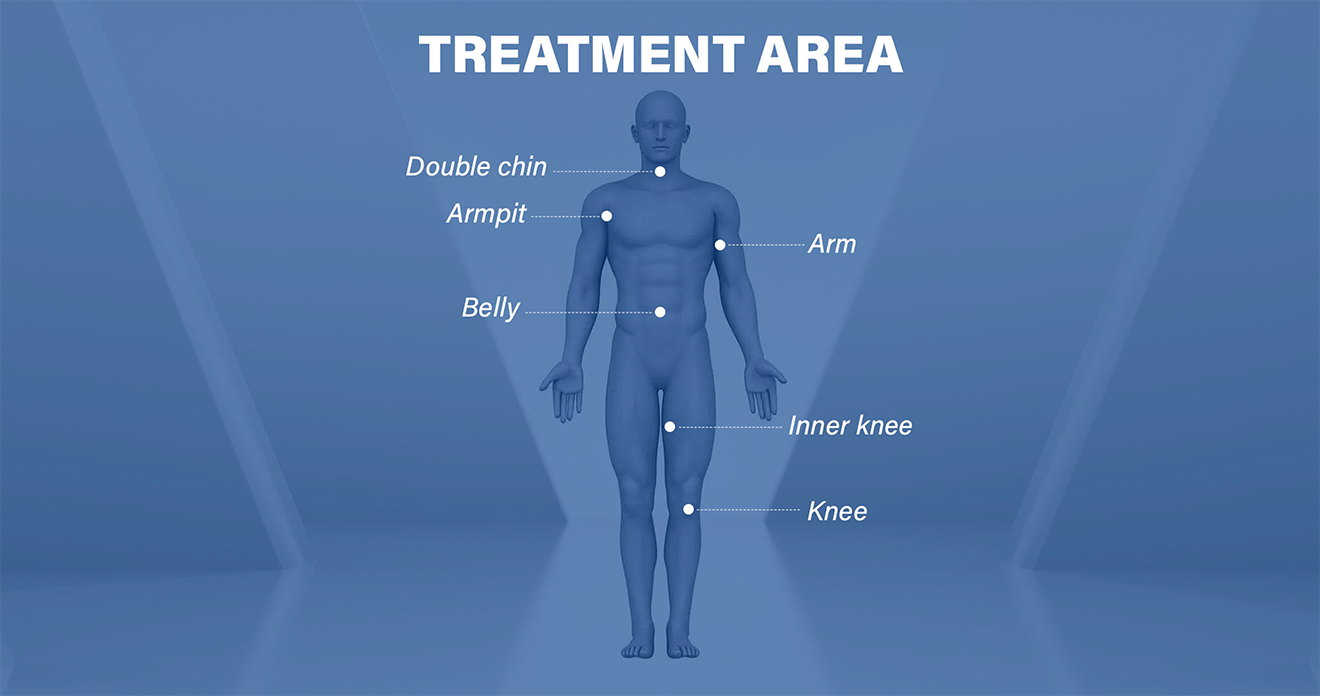 Cryo Slimming Weight Loss Device