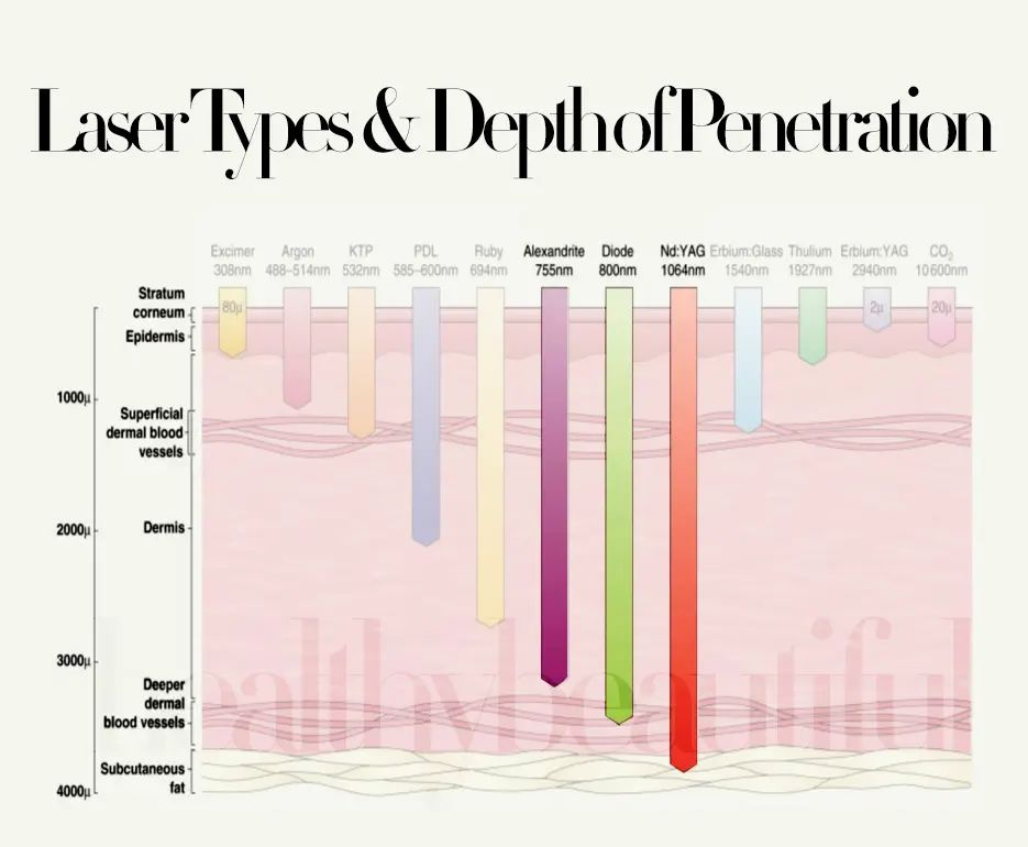 3 wavelengths diode laser vs single wavelength hair removal machine