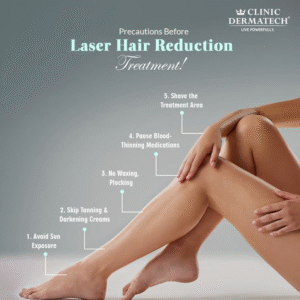 laser hair removal