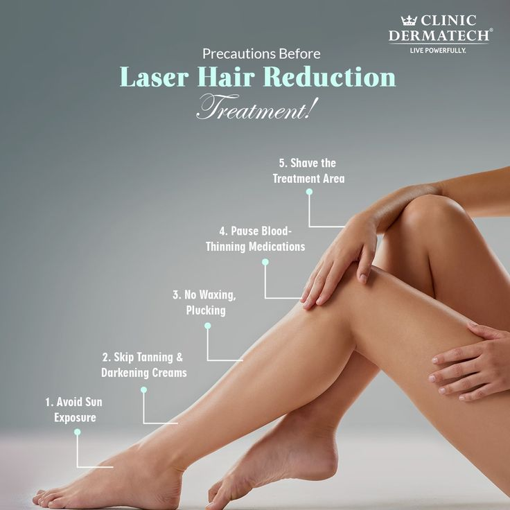 laser hair removal